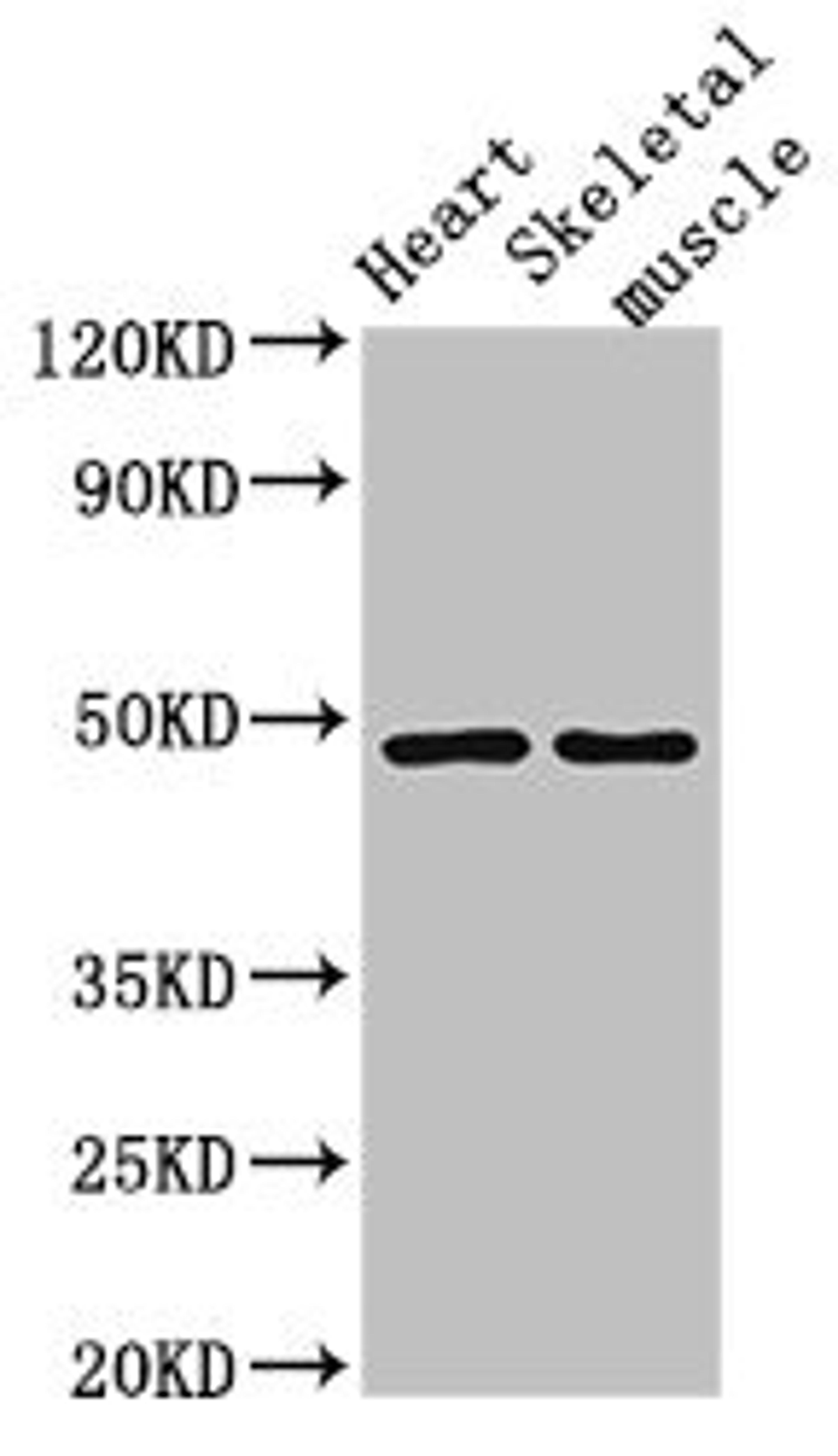 Western Blot. Positive WB detected in: Mouse heart tissue, Mouse skeletal muscle tissue. All lanes: CD36 antibody at 2ug/ml. Secondary. Goat polyclonal to rabbit IgG at 1/50000 dilution. Predicted band size: 54, 33, 49, 47 kDa. Observed band size: 49 kDa. 