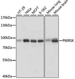 Western blot - P90RSK antibody (A15718)