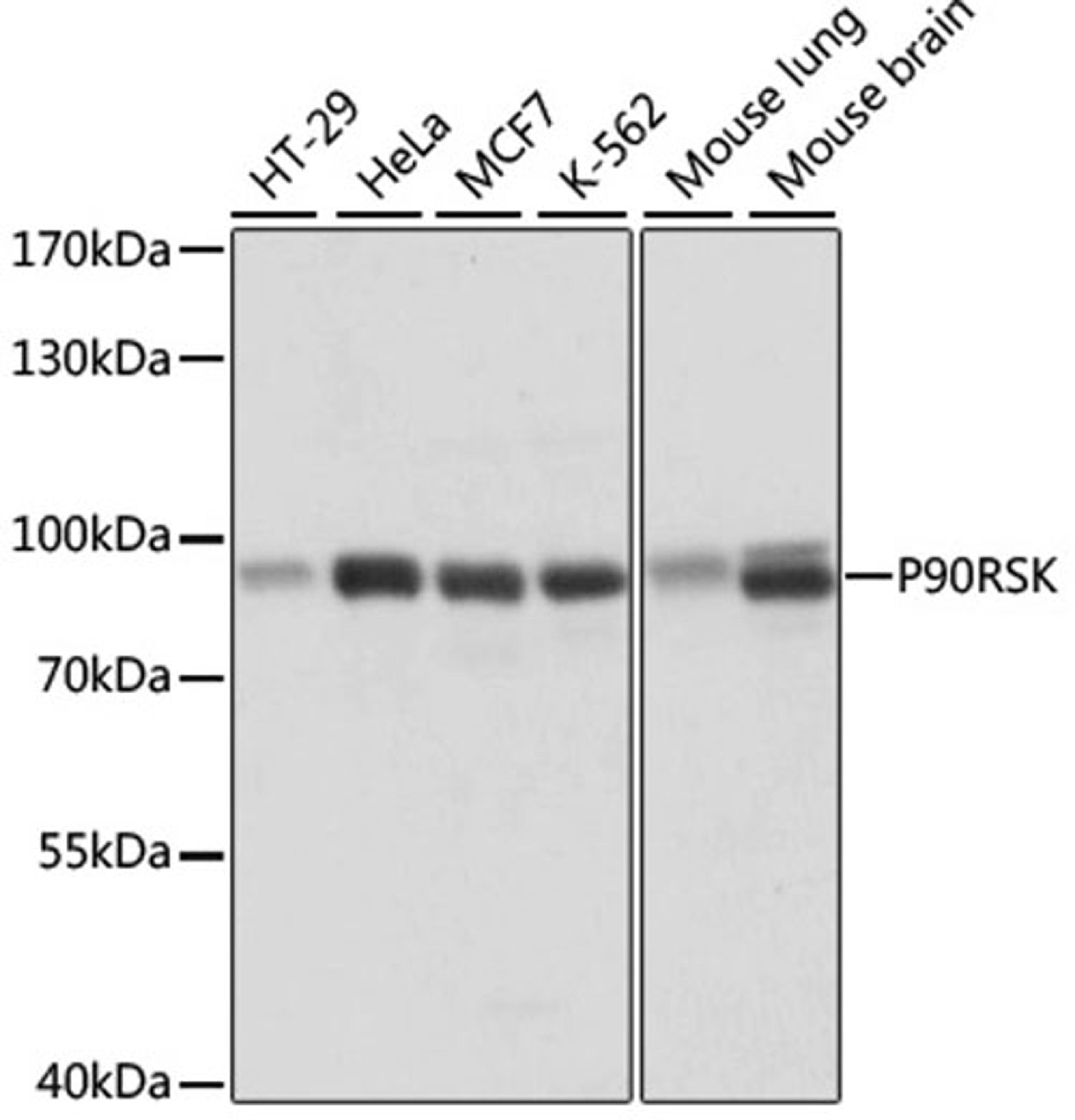 Western blot - P90RSK antibody (A15718)