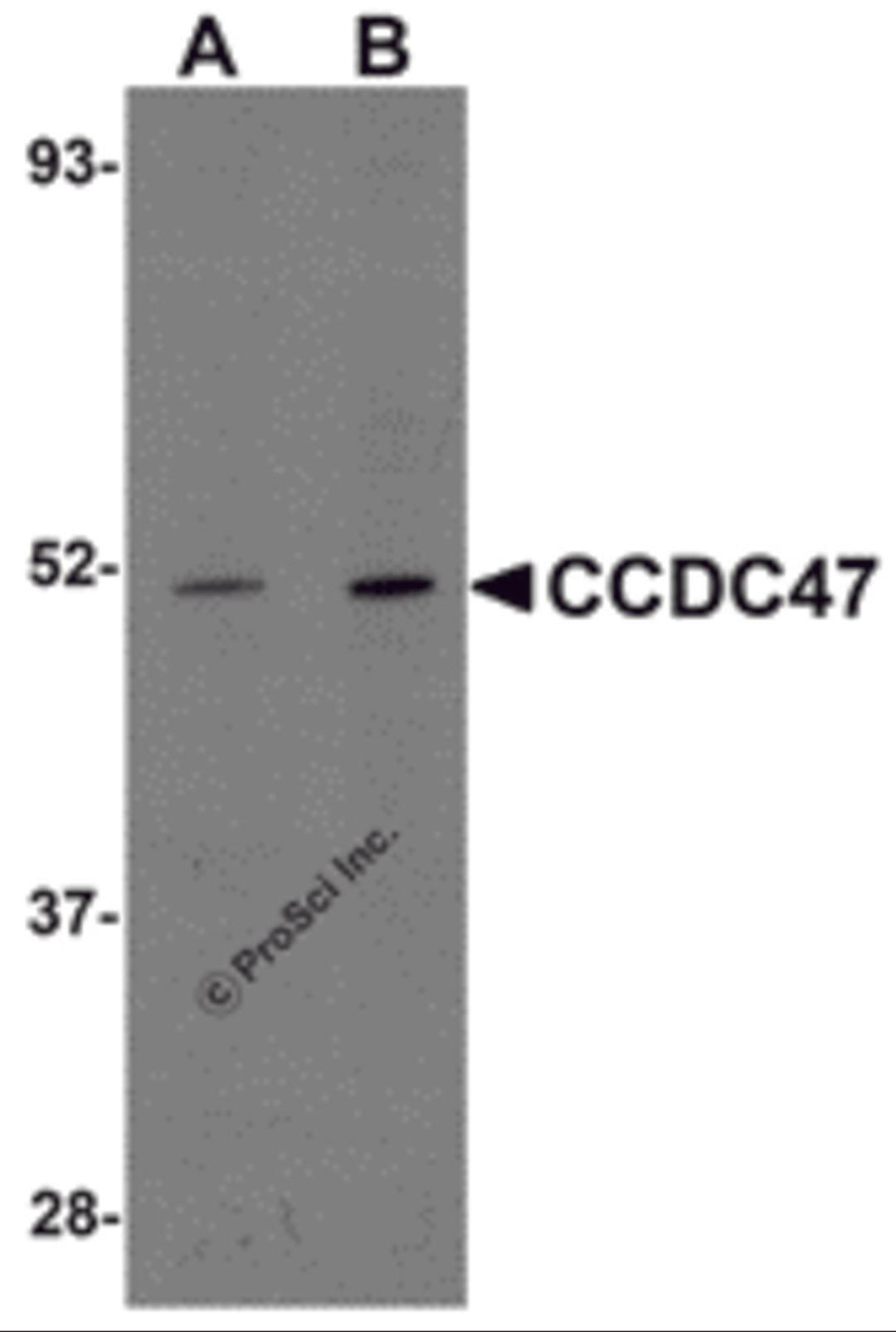 Western blot analysis of CCDC47 in mouse heart tissue lysate with CCDC47 antibody at (A) 1 and (B) 2 &#956;g/mL.