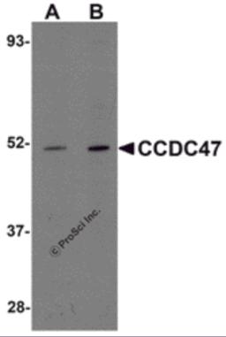 Western blot analysis of CCDC47 in mouse heart tissue lysate with CCDC47 antibody at (A) 1 and (B) 2 &#956;g/mL.