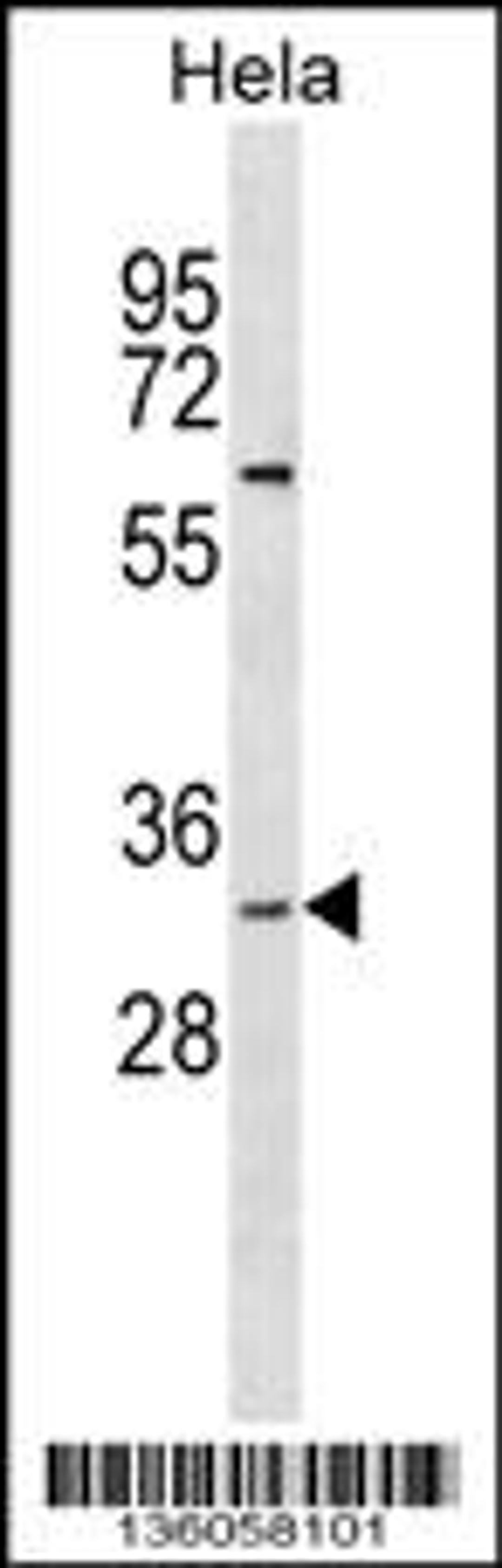 Western blot analysis in Hela cell line lysates (35ug/lane).