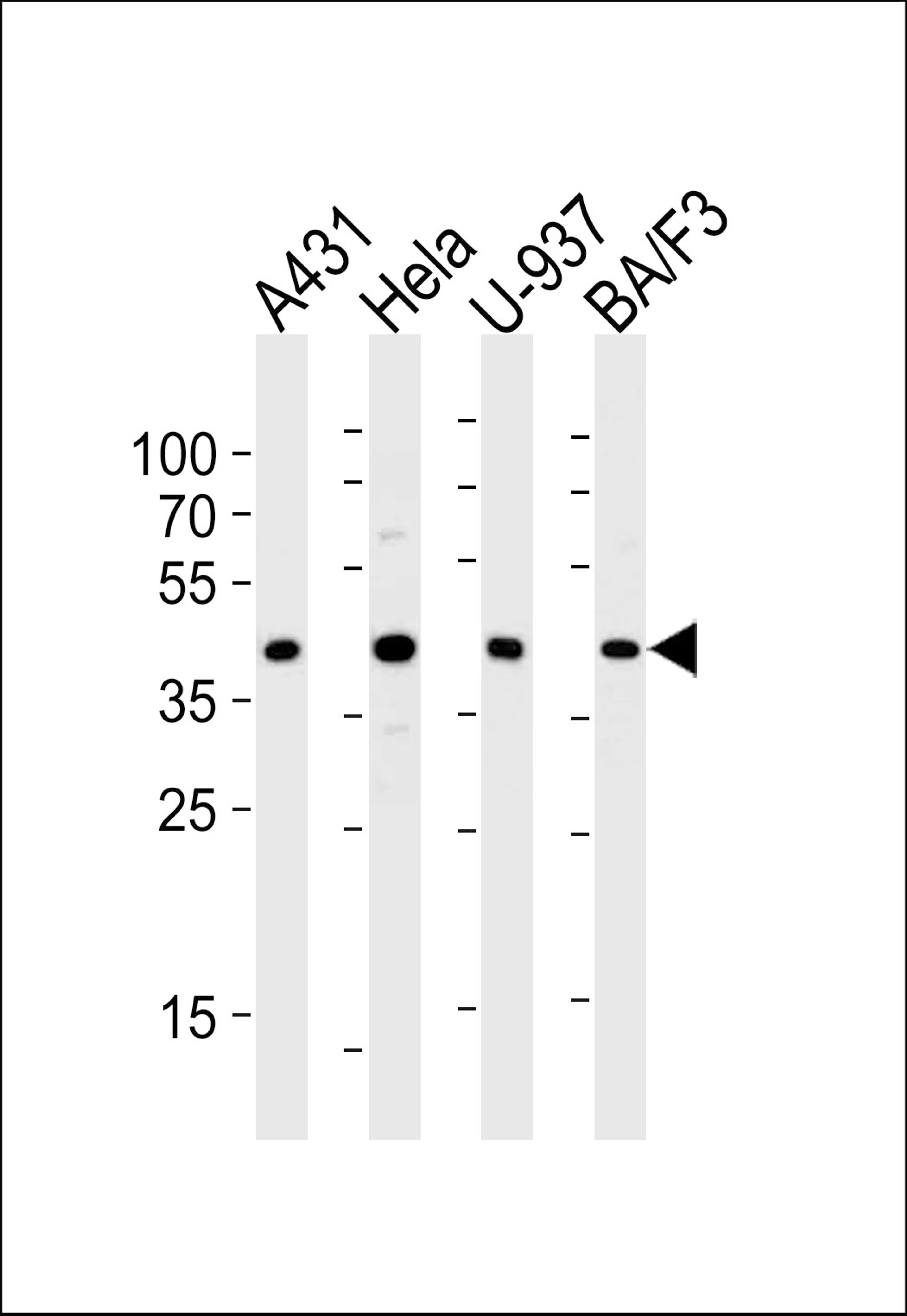 Western blot analysis of lysates from A431, Hela, U-937, BA/F3 cell line (from left to right), using PGK1 Antibody (S320) at 1:1000 at each lane.