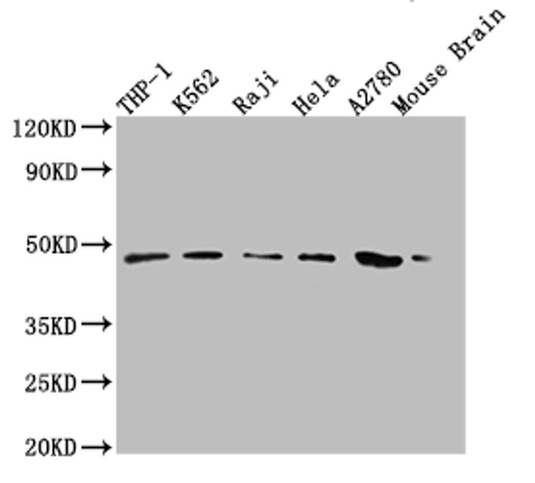 Western Blot. Positive WB detected in: THP-1 whole cell lysate, K-562 whole cell lysate, Raji whole cell lysate, Hela whole cell lysate, A2780 whole cell lysate, Mouse Brain tissue. All lanes: MR1 antibody at 1:2000. Secondary. Goat polyclonal to rabbit IgG at 1/50000 dilution. Predicted band size: 40, 35, 29, 26 kDa. Observed band size: 48 kDa.