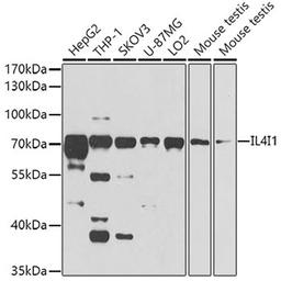 Western blot - IL4I1 antibody (A8378)