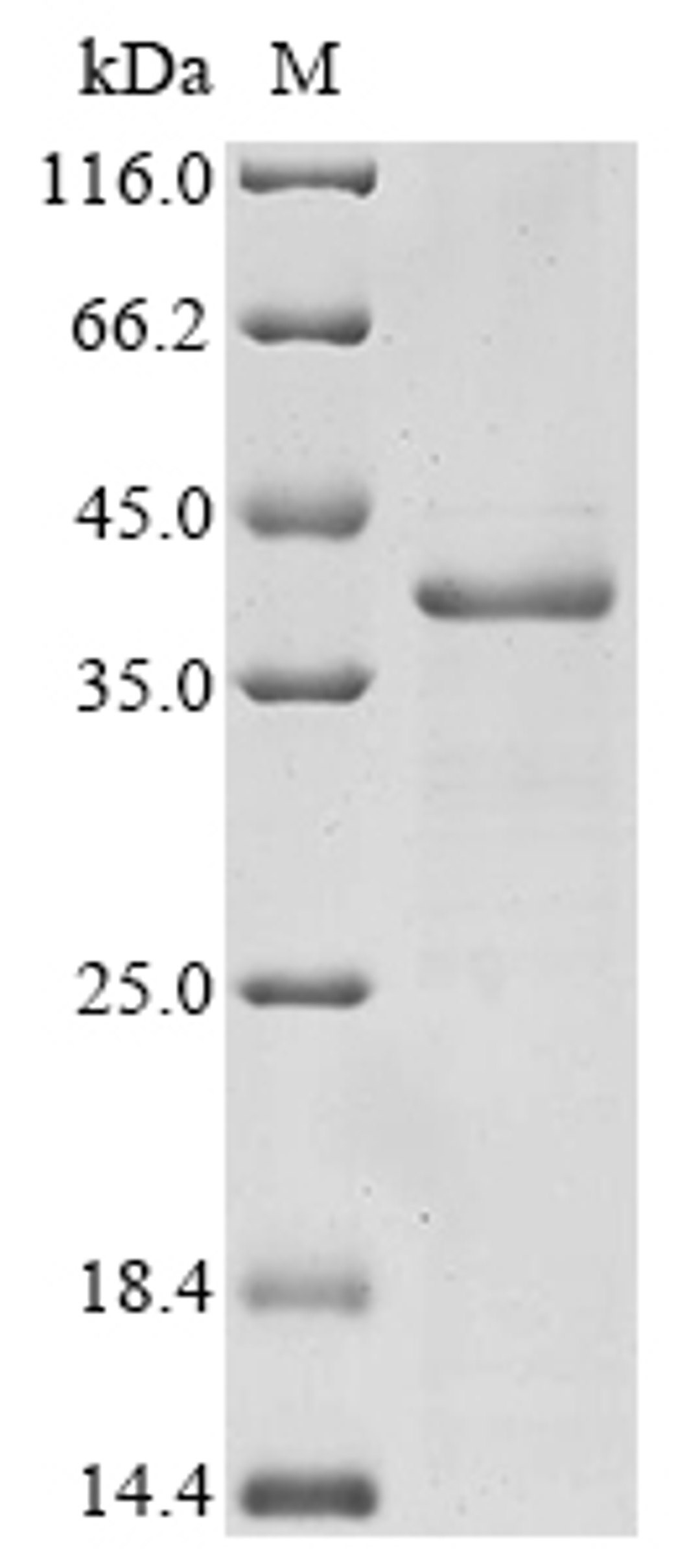 (Tris-Glycine gel) Discontinuous SDS-PAGE (reduced) with 5% enrichment gel and 15% separation gel.