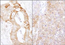 Detection of human and mouse eEF2 Kinase by immunohistochemistry.