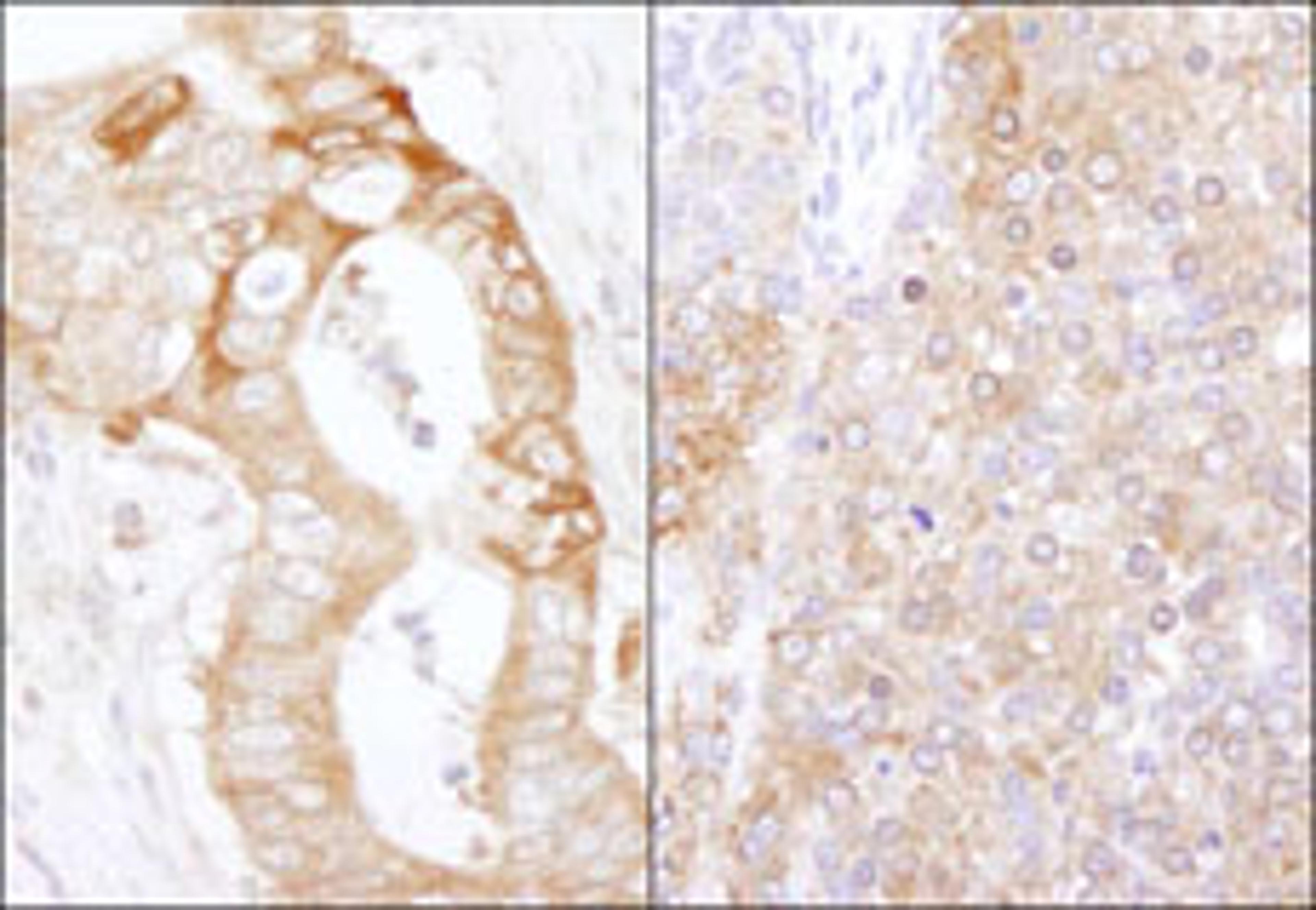 Detection of human and mouse eEF2 Kinase by immunohistochemistry.