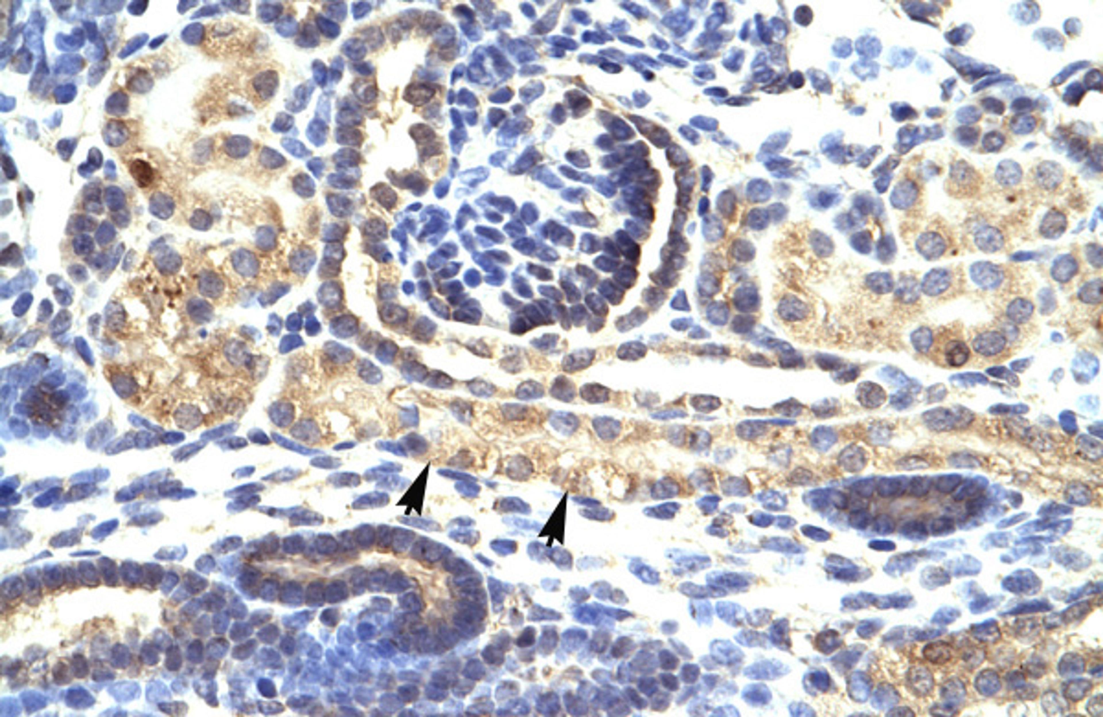 Antibody used in IHC on Human kidney.