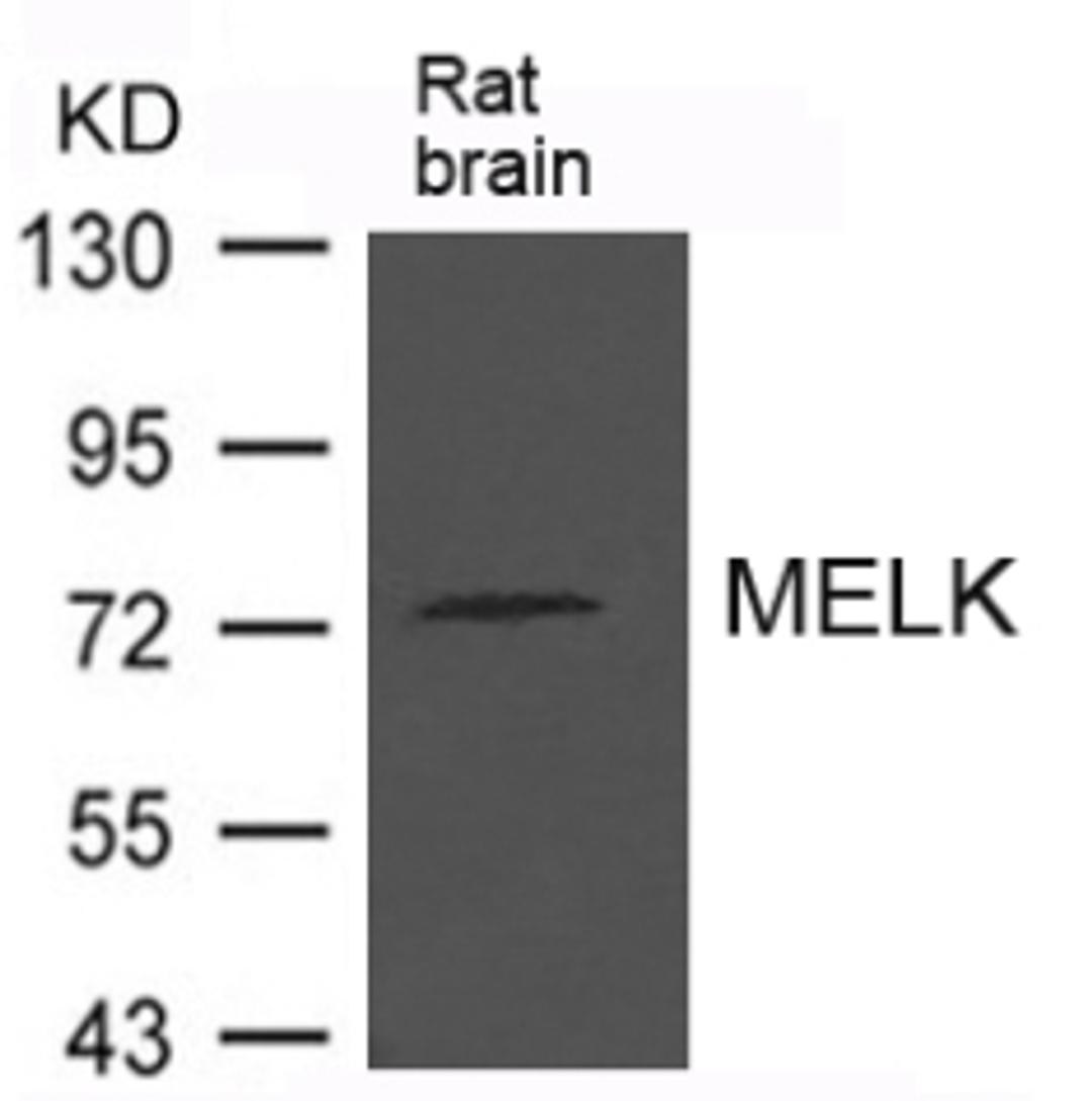 Western blot analysis of extract from Rat brain tissue using MELK Antibody.