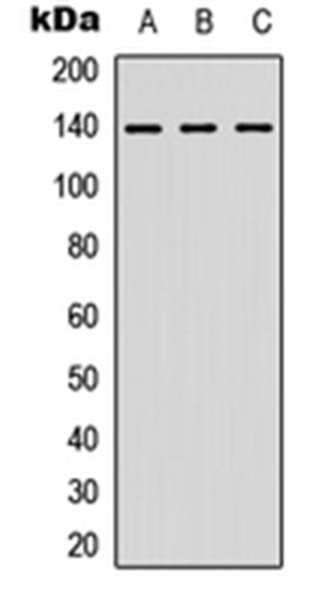 Western blot analysis of A549 (Lane 1), MCF7 (Lane 2), HeLa (Lane 3) whole cell lysates using NFAT3 antibody