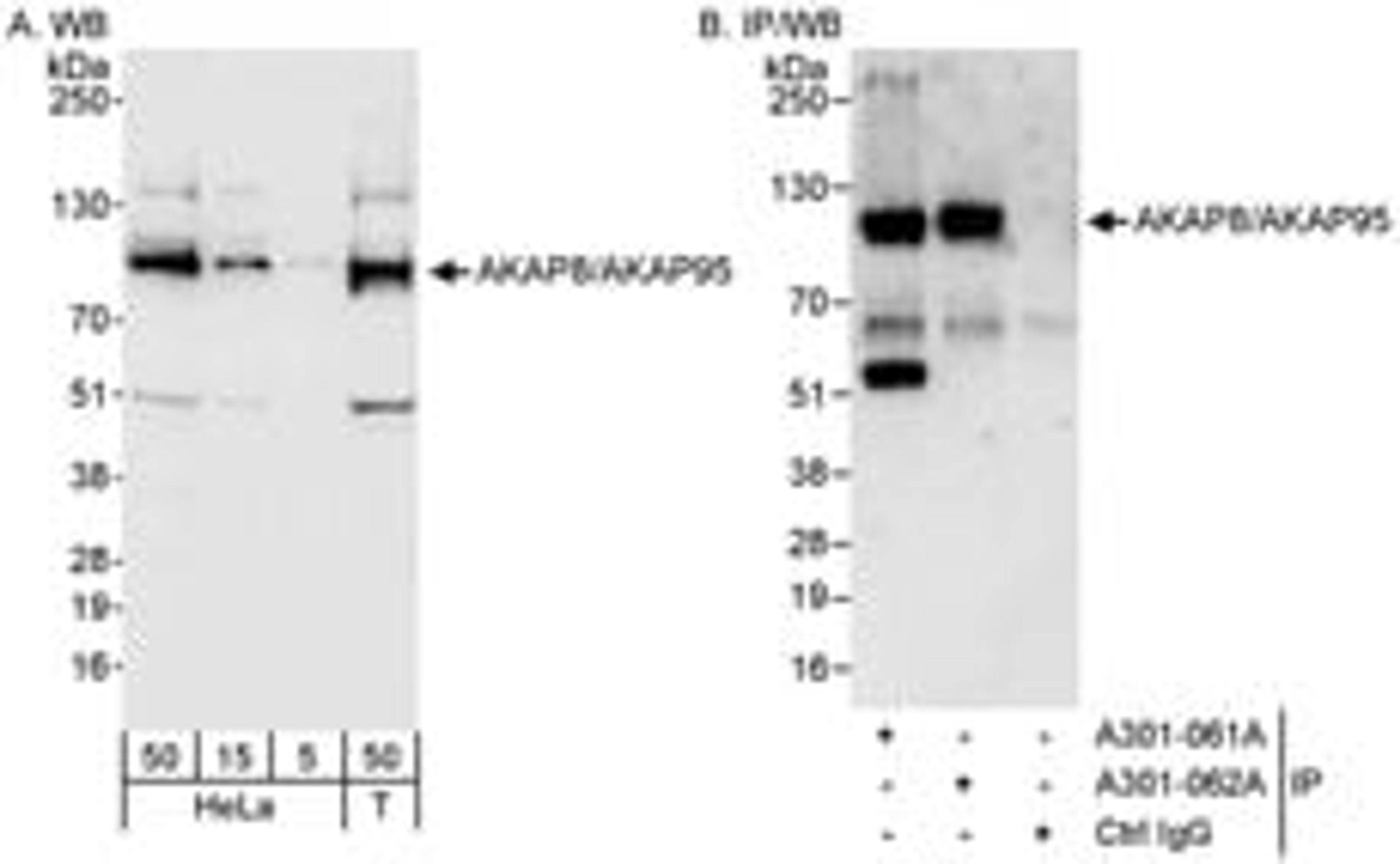 Detection of human AKAP8/AKAP95 by western blot and immunoprecipitation.