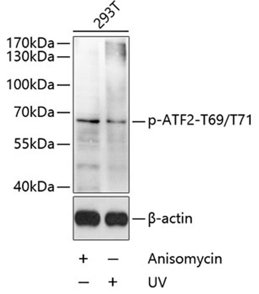 Western blot - Phospho-ATF2-T69/T71 antibody (AP0525)