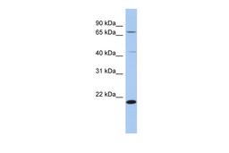 Antibody used in WB on Human THP-1 at 0.2-1 ug/ml.