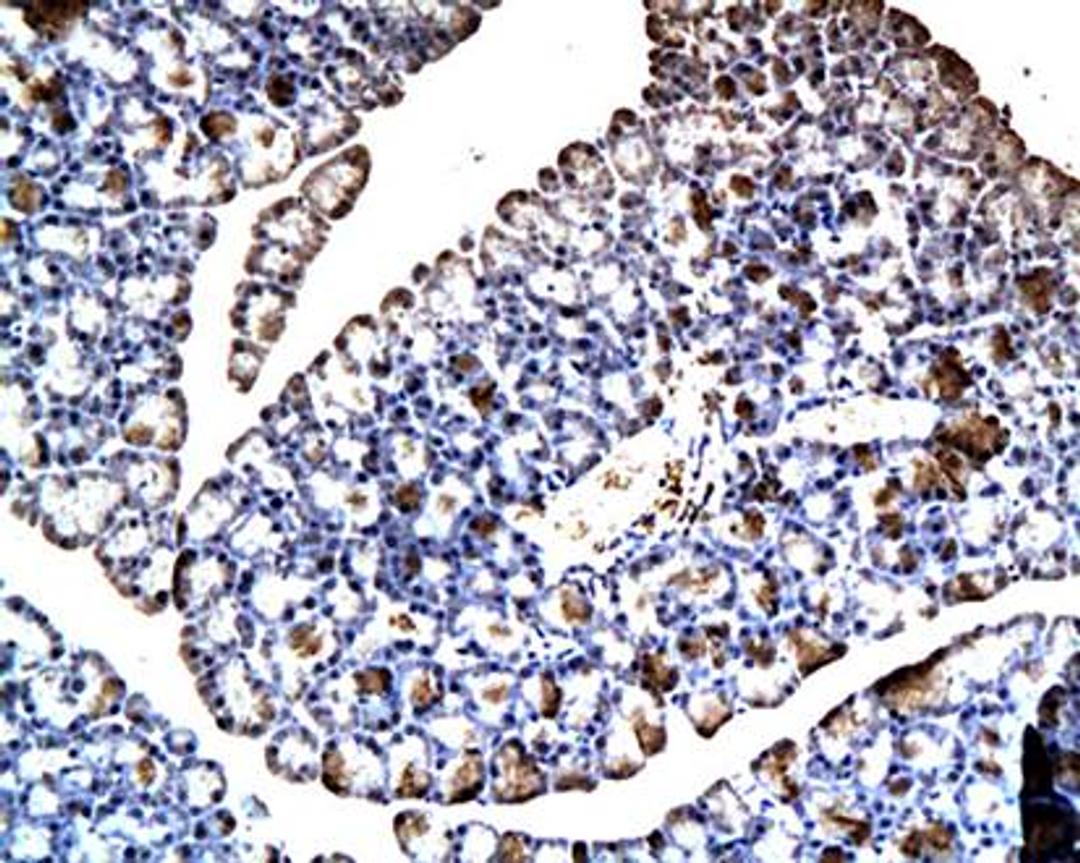 IHC-P of pancreatic tissues of rats (BSEP antibody at 1:200)