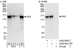 Detection of human SA2 by western blot and immunoprecipitation.