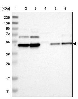 Western Blot: FAM172A Antibody [NBP1-86774] - Lane 1: Marker [kDa] 230, 130, 95, 72, 56, 36, 28, 17, 11<br/>Lane 2: Human cell line RT-4<br/>Lane 3: Human cell line U-251MG sp<br/>Lane 4: Human plasma (IgG/HSA depleted)<br/>Lane 5: Human liver tissue<br/>Lane 6: Human tonsil tissue