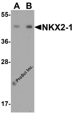 Western blot analysis of NKX2-1 expression in human lung tissue lysate with NKX2-1 antibody at (A) 0.25 and (B) 0.5 μg/ml.