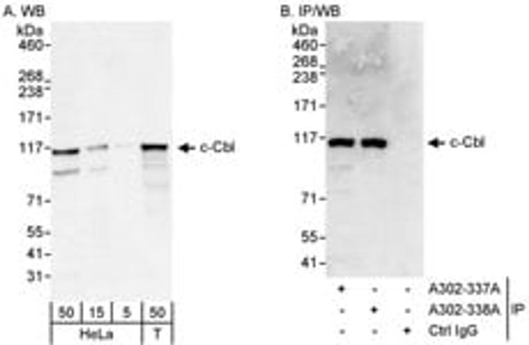 Detection of human c-Cbl by western blot and immunoprecipitation.