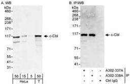 Detection of human c-Cbl by western blot and immunoprecipitation.