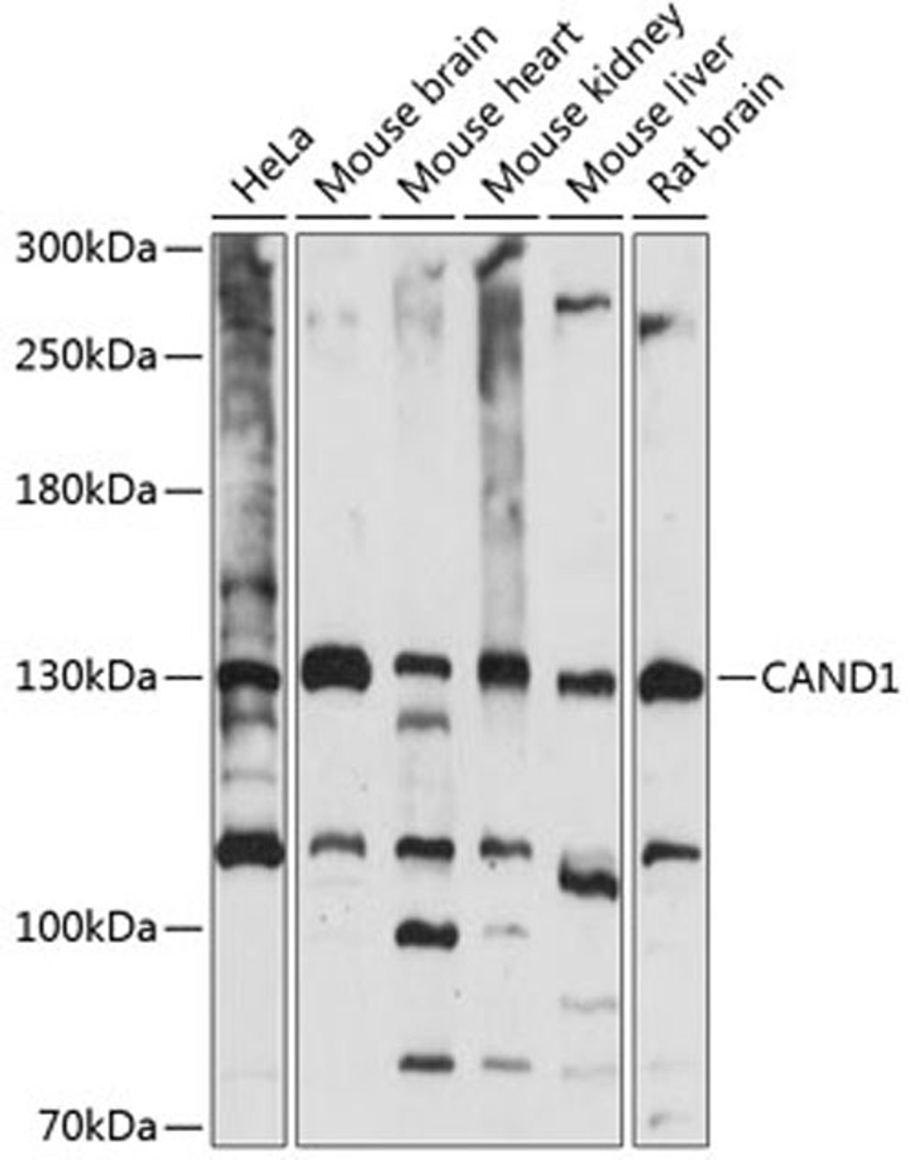 Western blot - CAND1 antibody (A14287)