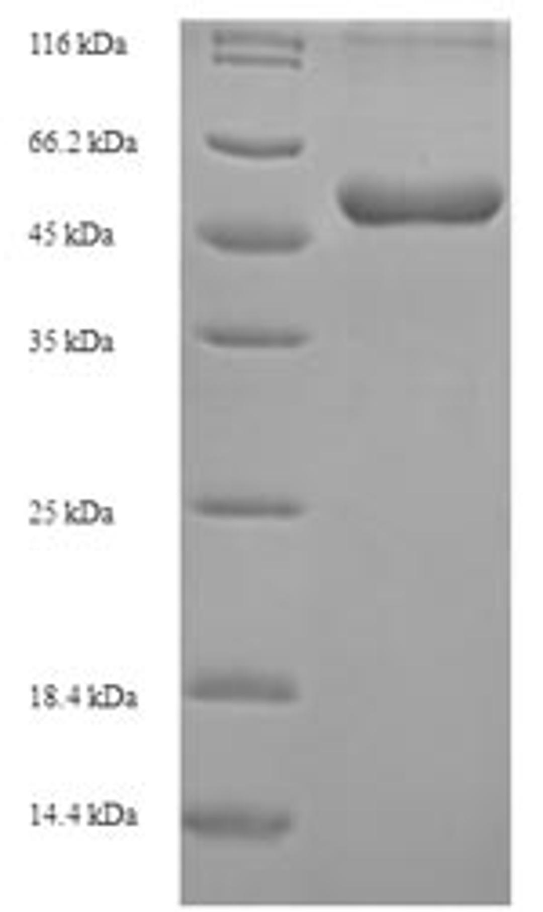 (Tris-Glycine gel) Discontinuous SDS-PAGE (reduced) with 5% enrichment gel and 15% separation gel.
