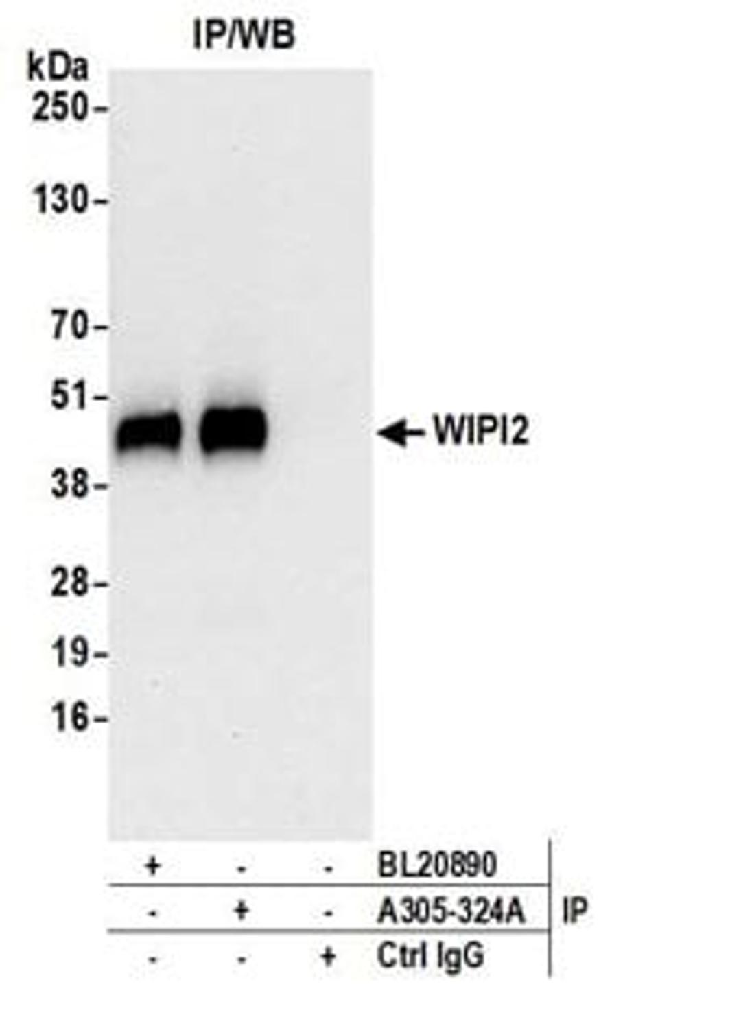 Detection of human WIPI2 by western blot of immunoprecipitates.