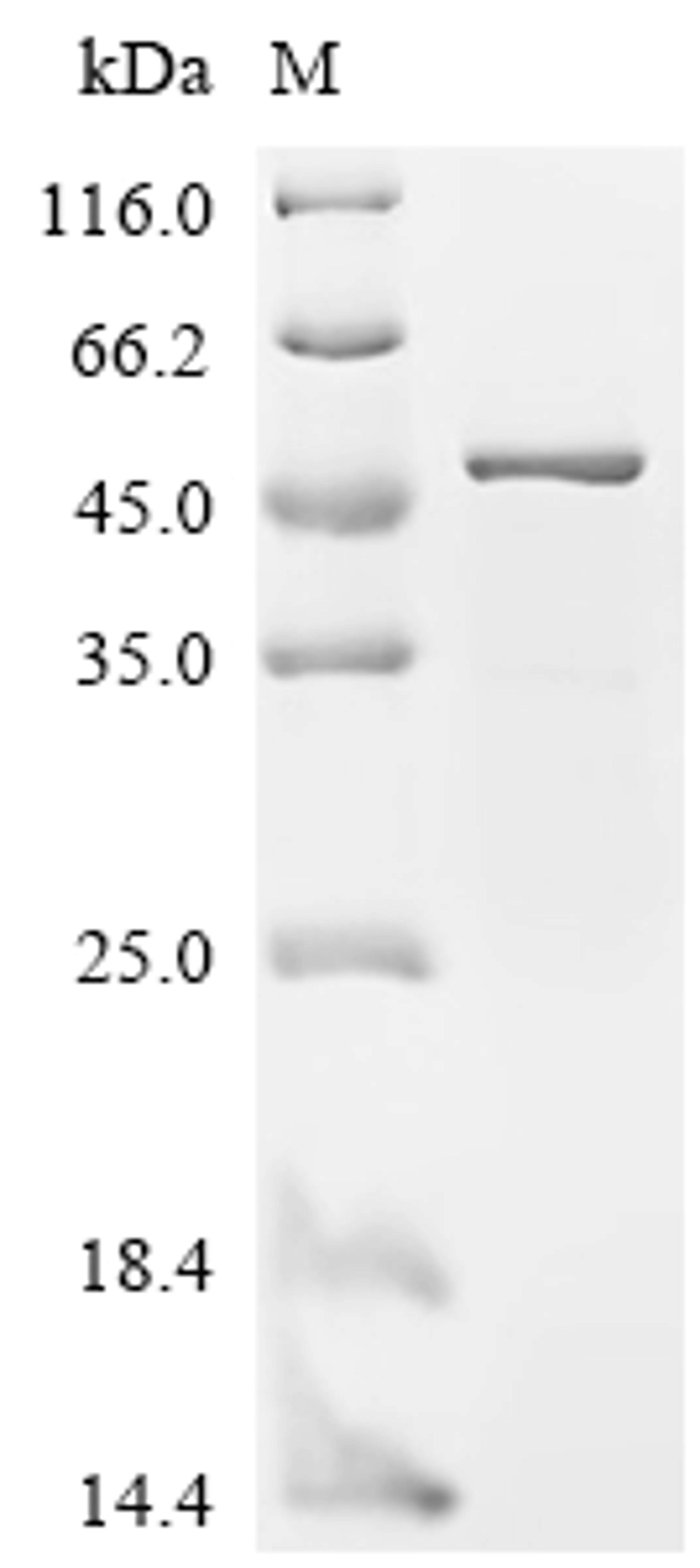 (Tris-Glycine gel) Discontinuous SDS-PAGE (reduced) with 5% enrichment gel and 15% separation gel.