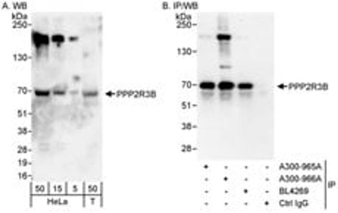 Detection of human PPP2R3B by western blot and immunoprecipitation.