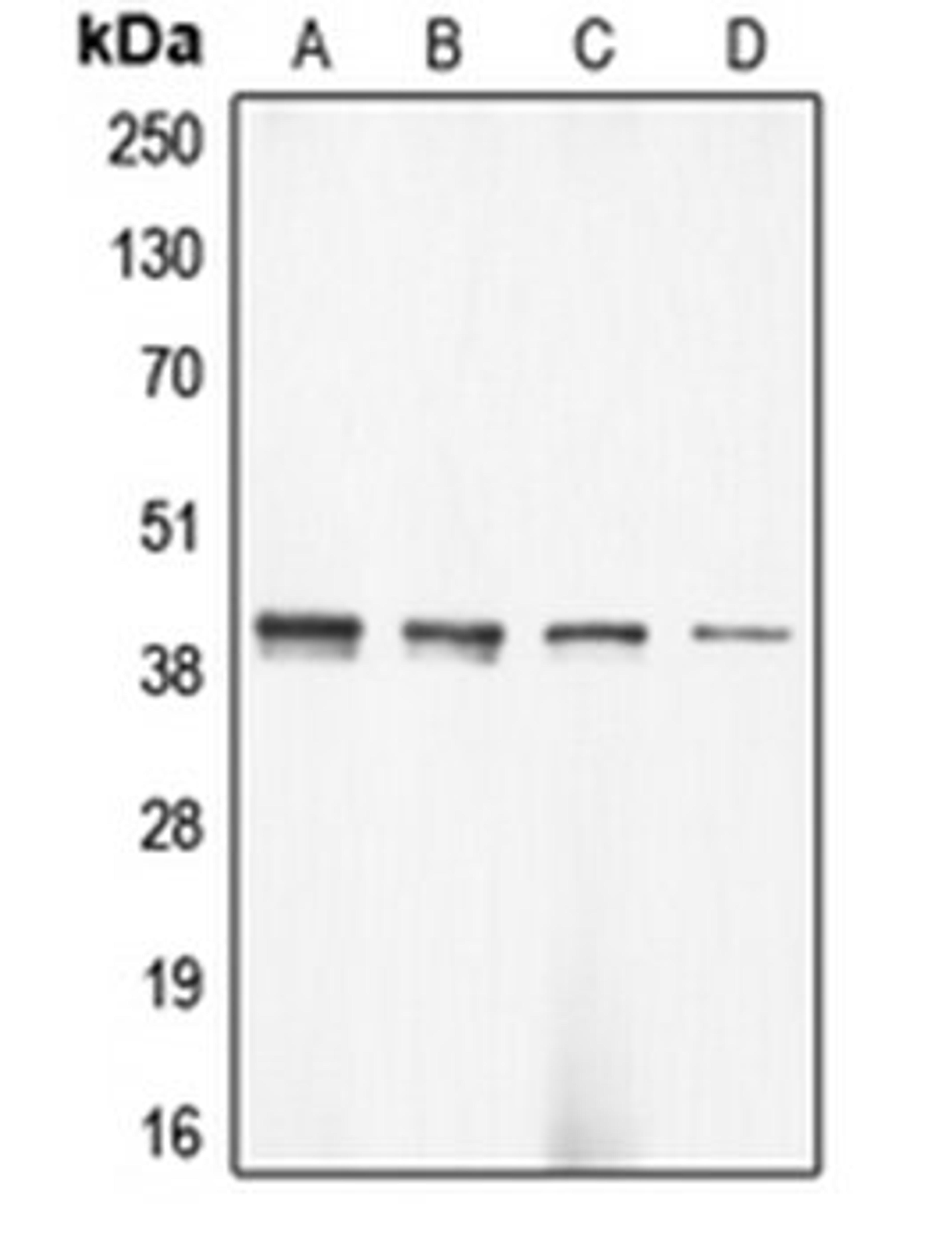 Western blot analysis of DLD (Lane 1), HeLa (Lane 2), mouse brain (Lane 3), rat brain (Lane 4) whole cell lysates using ACTG2 antibody