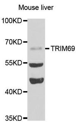 Western blot analysis of extracts of mousetestis tissue lines using TRIM69 antibody