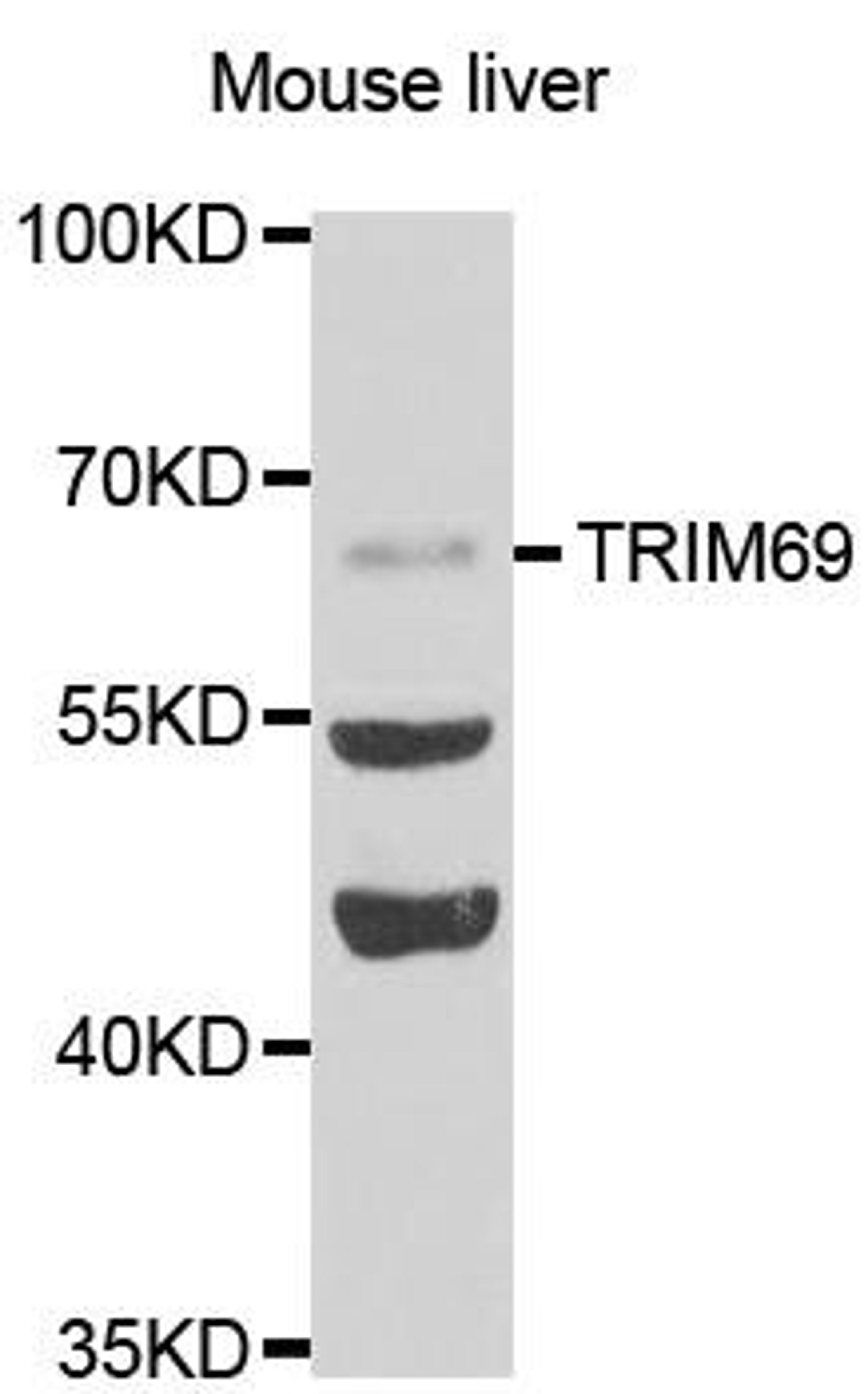 Western blot analysis of extracts of mousetestis tissue lines using TRIM69 antibody