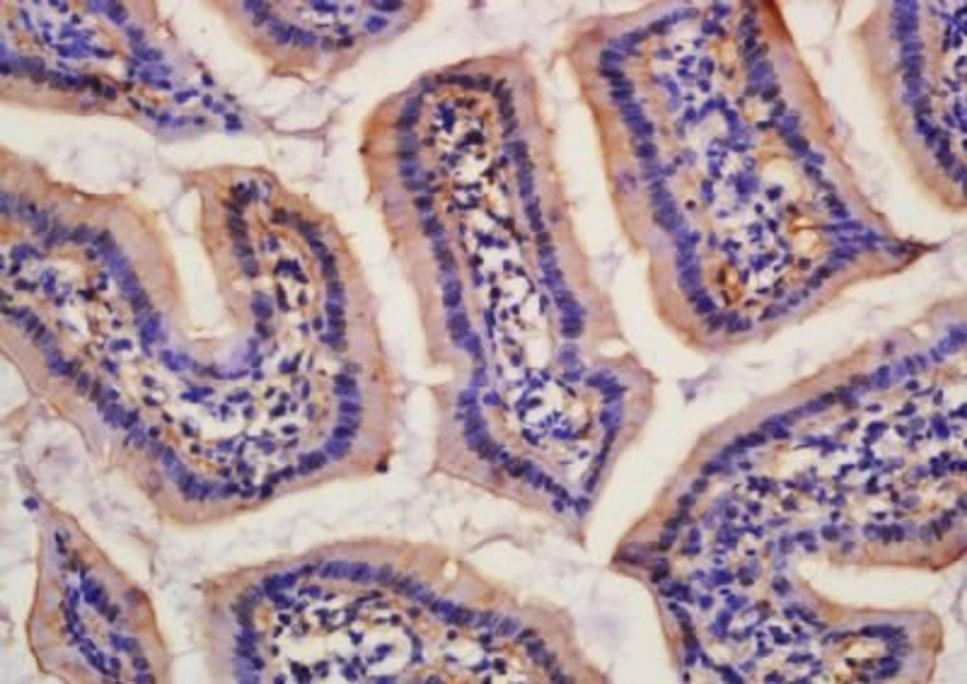 Immunohistochemical analysis of formalin-fixed paraffin embedded rat kidney tissue using SLC7A9 antibody (dilution at 1:200)