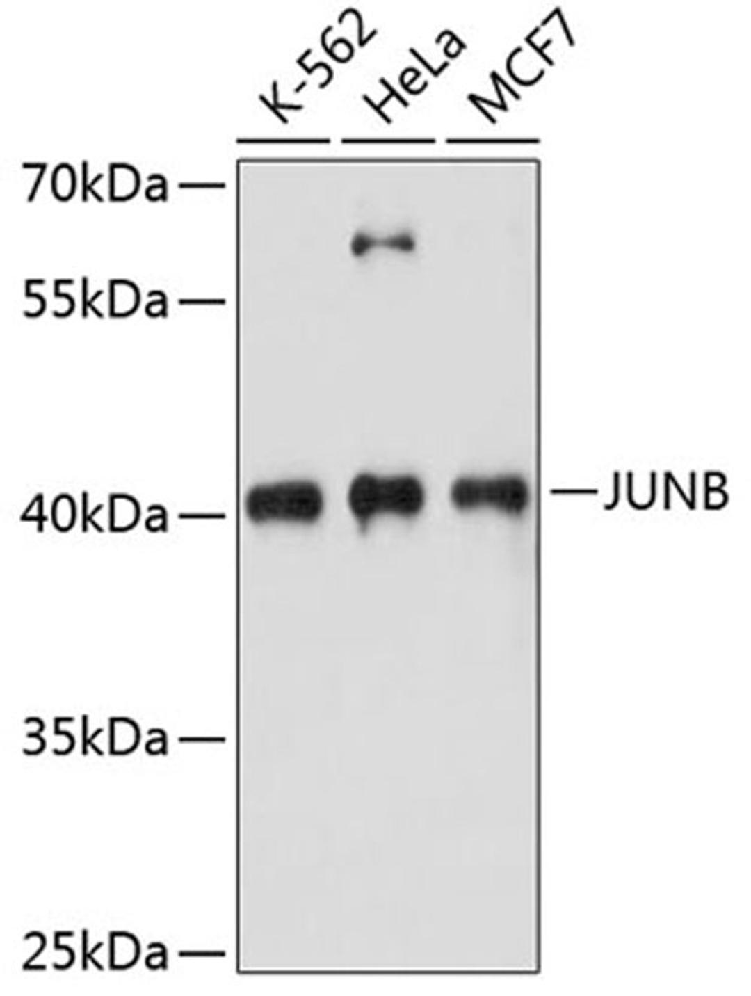 Western blot - JUNB antibody (A14566)