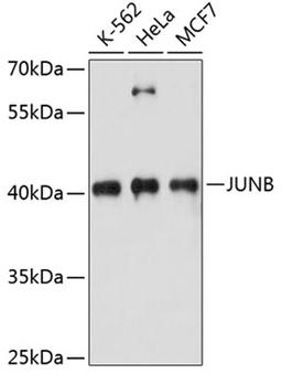 Western blot - JUNB antibody (A14566)