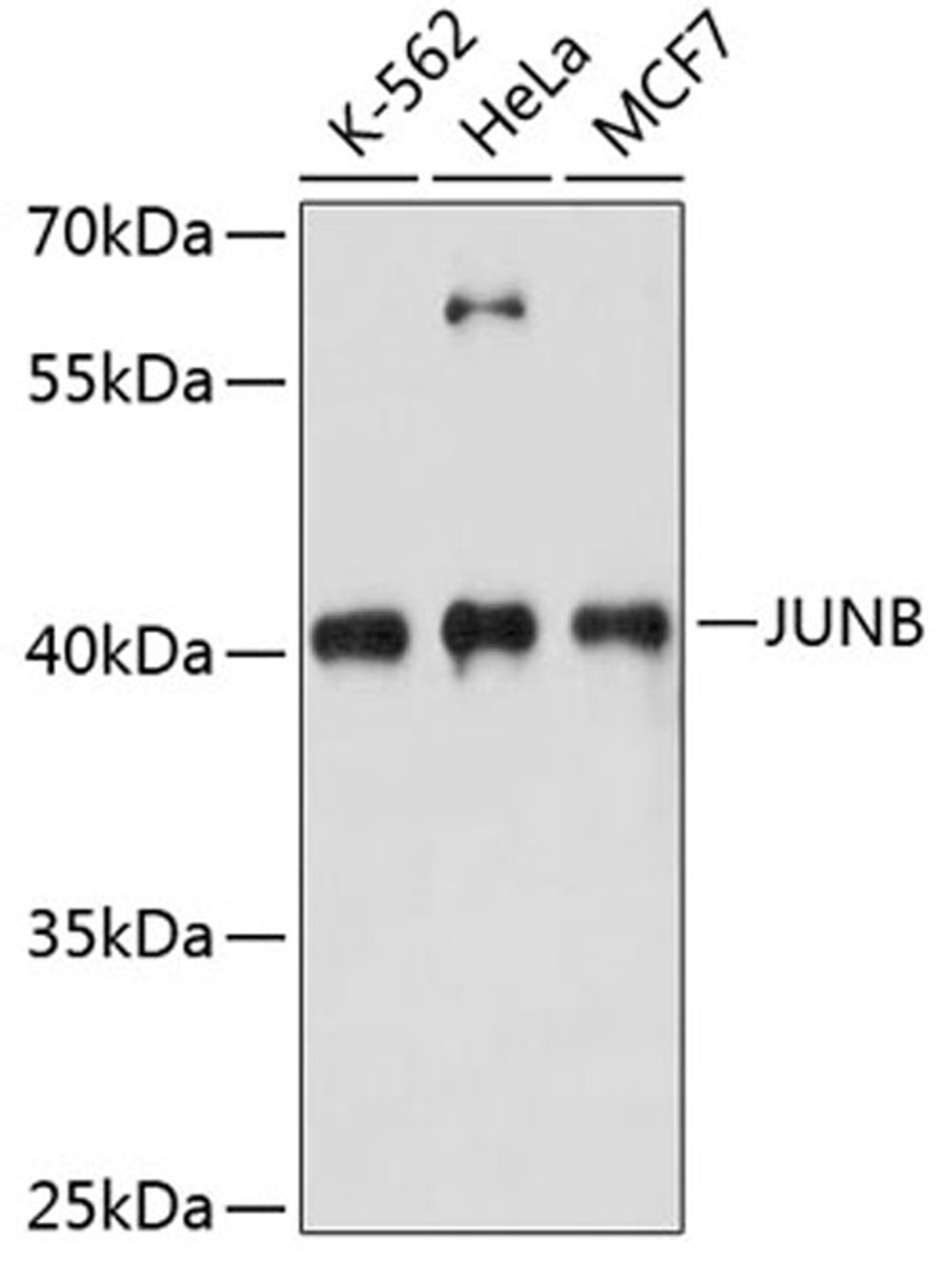 Western blot - JUNB antibody (A14566)