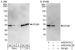 Detection of human and mouse OTUB1 by western blot (h&m) and immunoprecipitation (h).