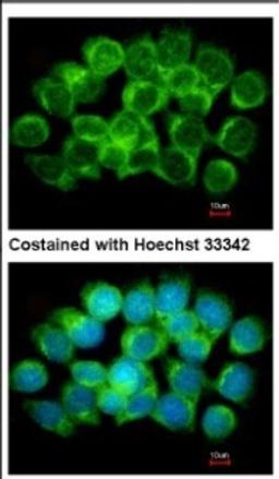 Immunocytochemistry/Immunofluorescence: S Adenosylhomocysteine Hydrolase Antibody [NBP2-20246] - Immunofluorescence analysis of methanol-fixed A431, using antibody at 1:500 dilution.