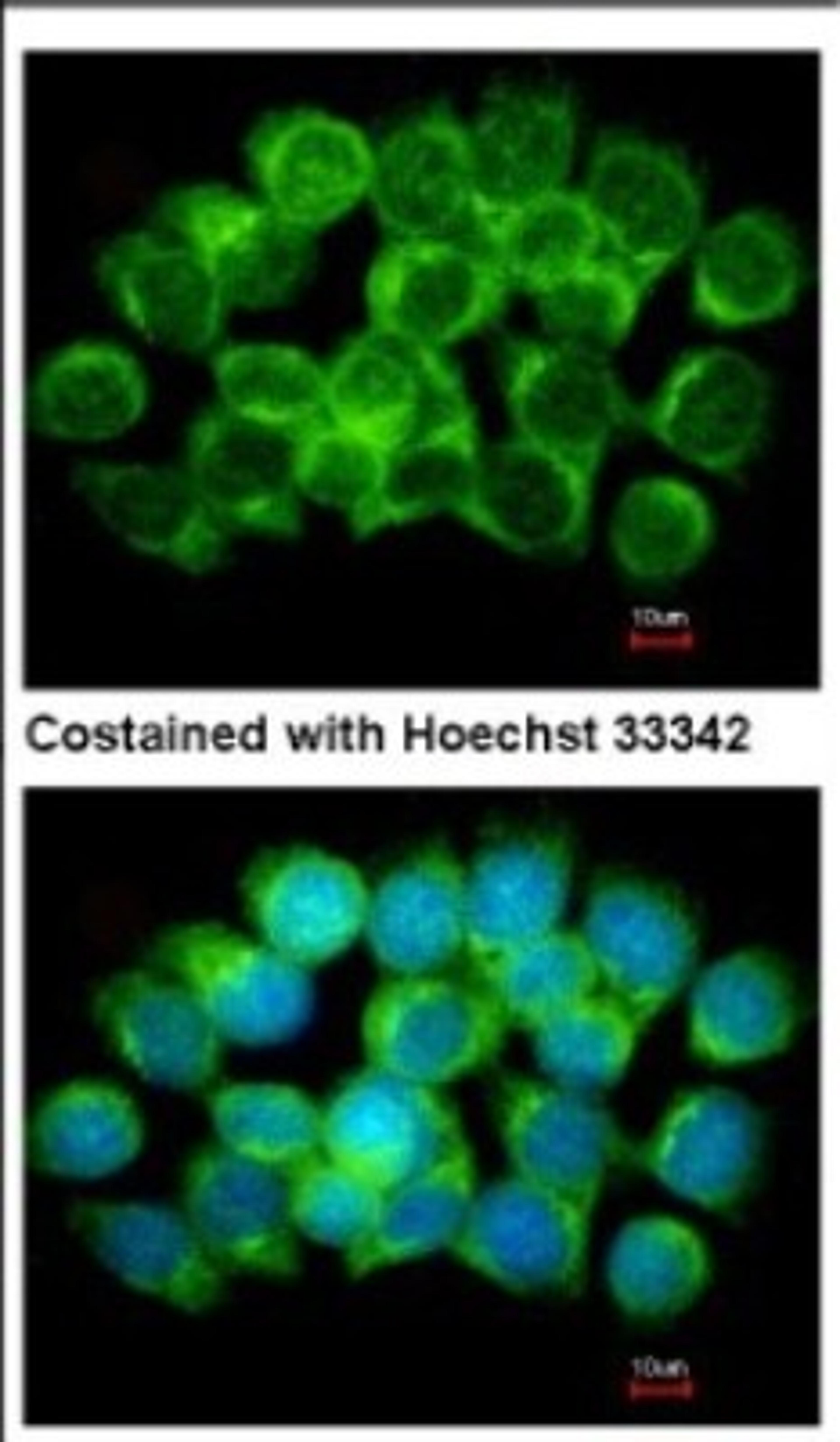 Immunocytochemistry/Immunofluorescence: S Adenosylhomocysteine Hydrolase Antibody [NBP2-20246] - Immunofluorescence analysis of methanol-fixed A431, using antibody at 1:500 dilution.