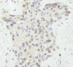 Immunohistochemistry-Paraffin: FLASH Antibody [NB100-81646] - FFPE section of human prostate nodular hypertrophy.  Affinity purified rabbit anti-FLASH used at a dilution of 1:250.