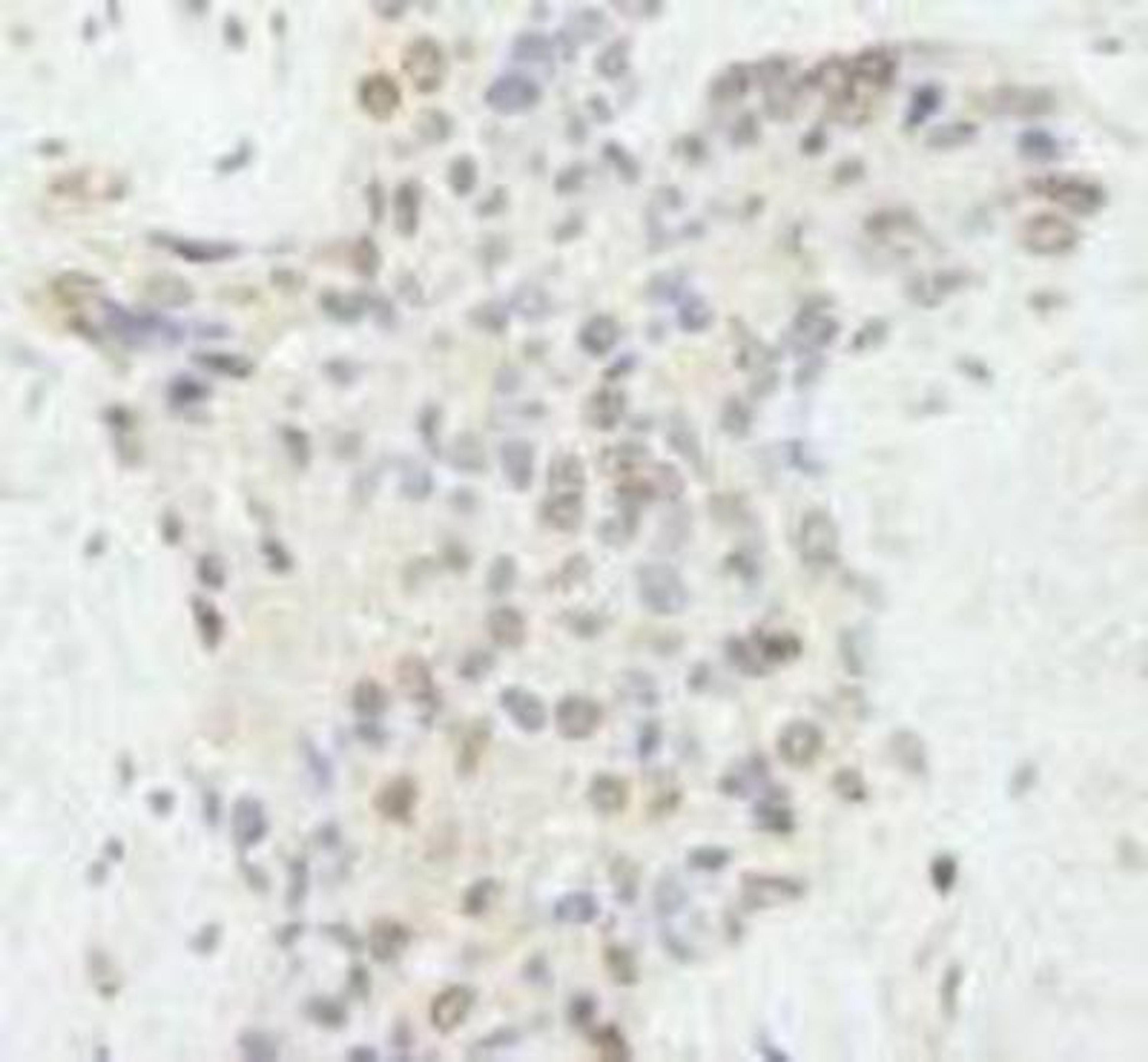 Immunohistochemistry-Paraffin: FLASH Antibody [NB100-81646] - FFPE section of human prostate nodular hypertrophy.  Affinity purified rabbit anti-FLASH used at a dilution of 1:250.