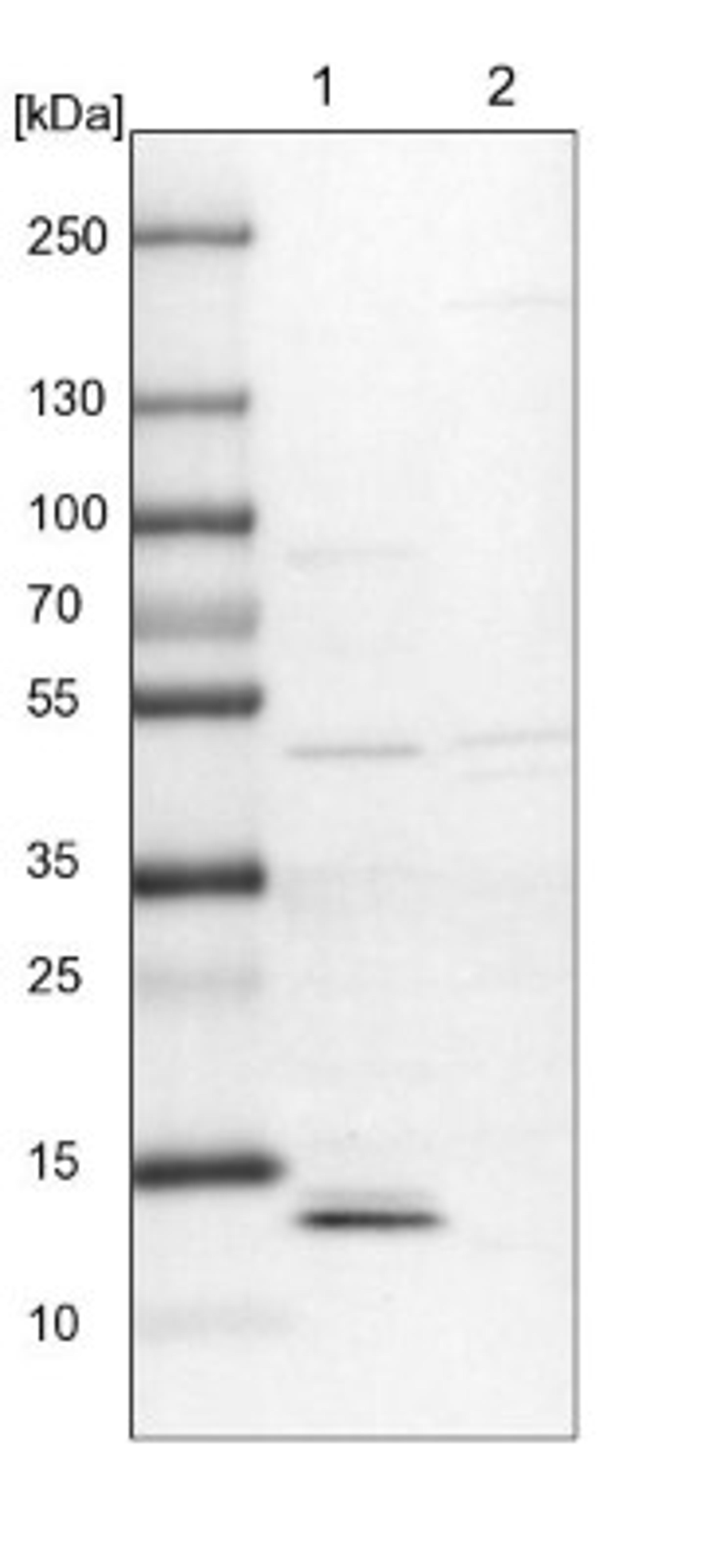 Western Blot: Prostaglandin E Synthase Antibody [NBP1-87852] - Lane 1: NIH-3T3 cell lysate (Mouse embryonic fibroblast cells)<br/>Lane 2: NBT-II cell lysate (Rat Wistar bladder tumour cells)