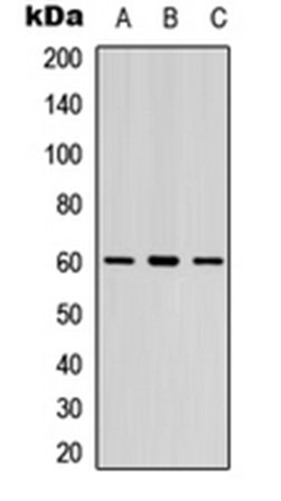 Western blot analysis of Jurkat (Lane 1), human spleen (Lane 2), mouse lung (Lane 3) whole cell lysates using LYN (Phospho-Y397) antibody