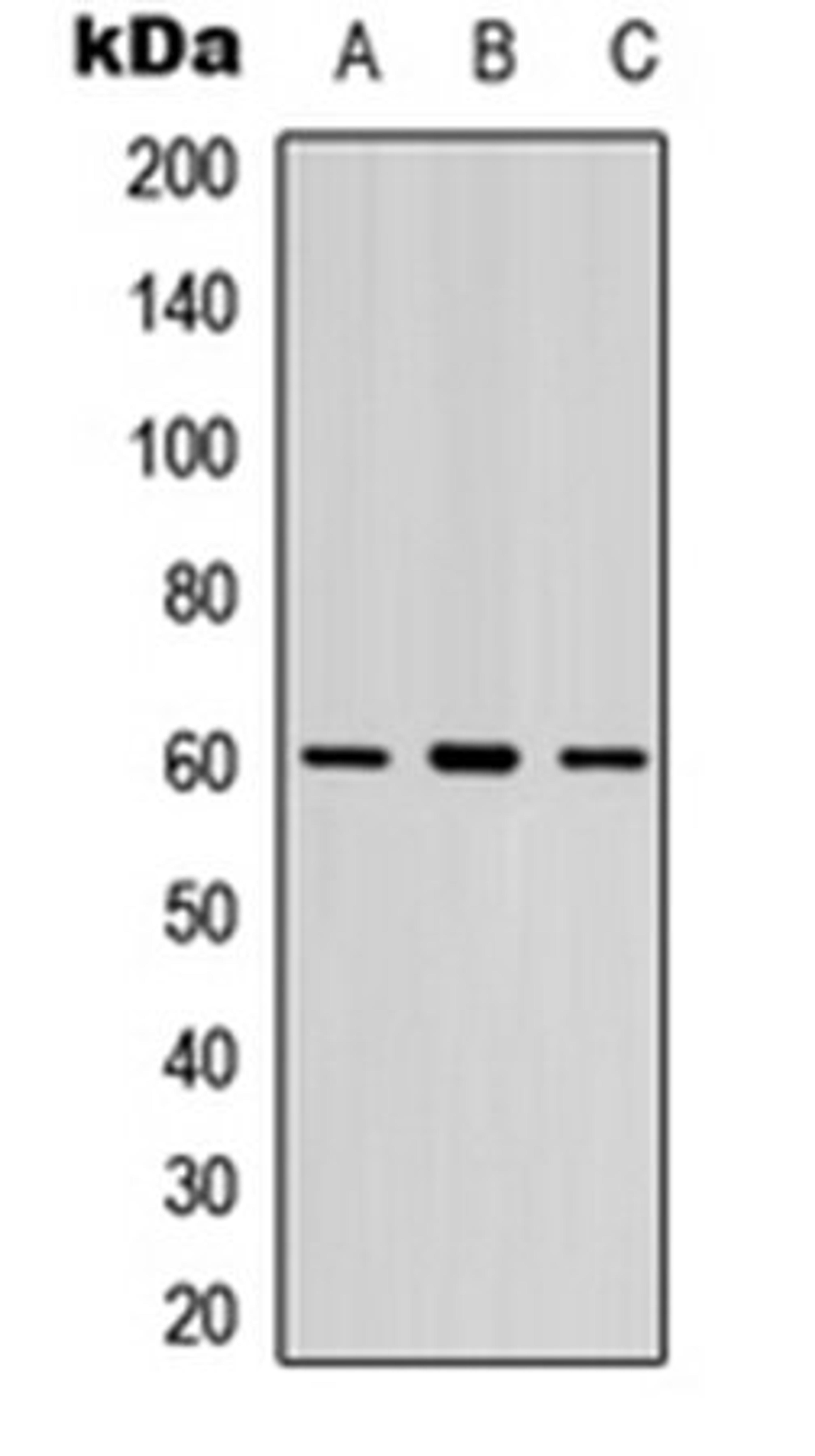 Western blot analysis of Jurkat (Lane 1), human spleen (Lane 2), mouse lung (Lane 3) whole cell lysates using LYN (Phospho-Y397) antibody