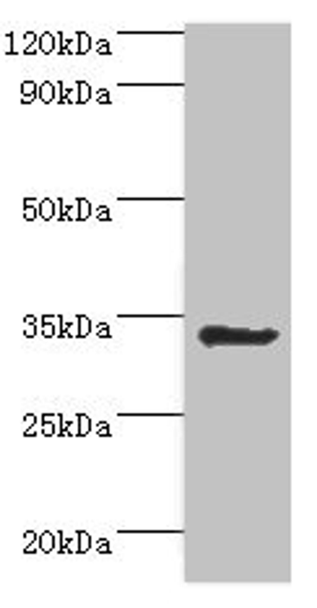 Western blot. All lanes: Aminoacyl tRNA synthase complex-interacting multifunctional protein 1 antibody at 2ug/ml + HepG2 whole cell lysate. Secondary. Goat polyclonal to rabbit IgG at 1/10000 dilution. Predicted band size: 35, 38 kDa. Observed band size: 35 kDa. 