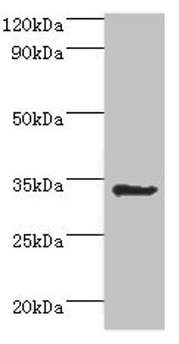 Western blot. All lanes: Aminoacyl tRNA synthase complex-interacting multifunctional protein 1 antibody at 2ug/ml + HepG2 whole cell lysate. Secondary. Goat polyclonal to rabbit IgG at 1/10000 dilution. Predicted band size: 35, 38 kDa. Observed band size: 35 kDa. 