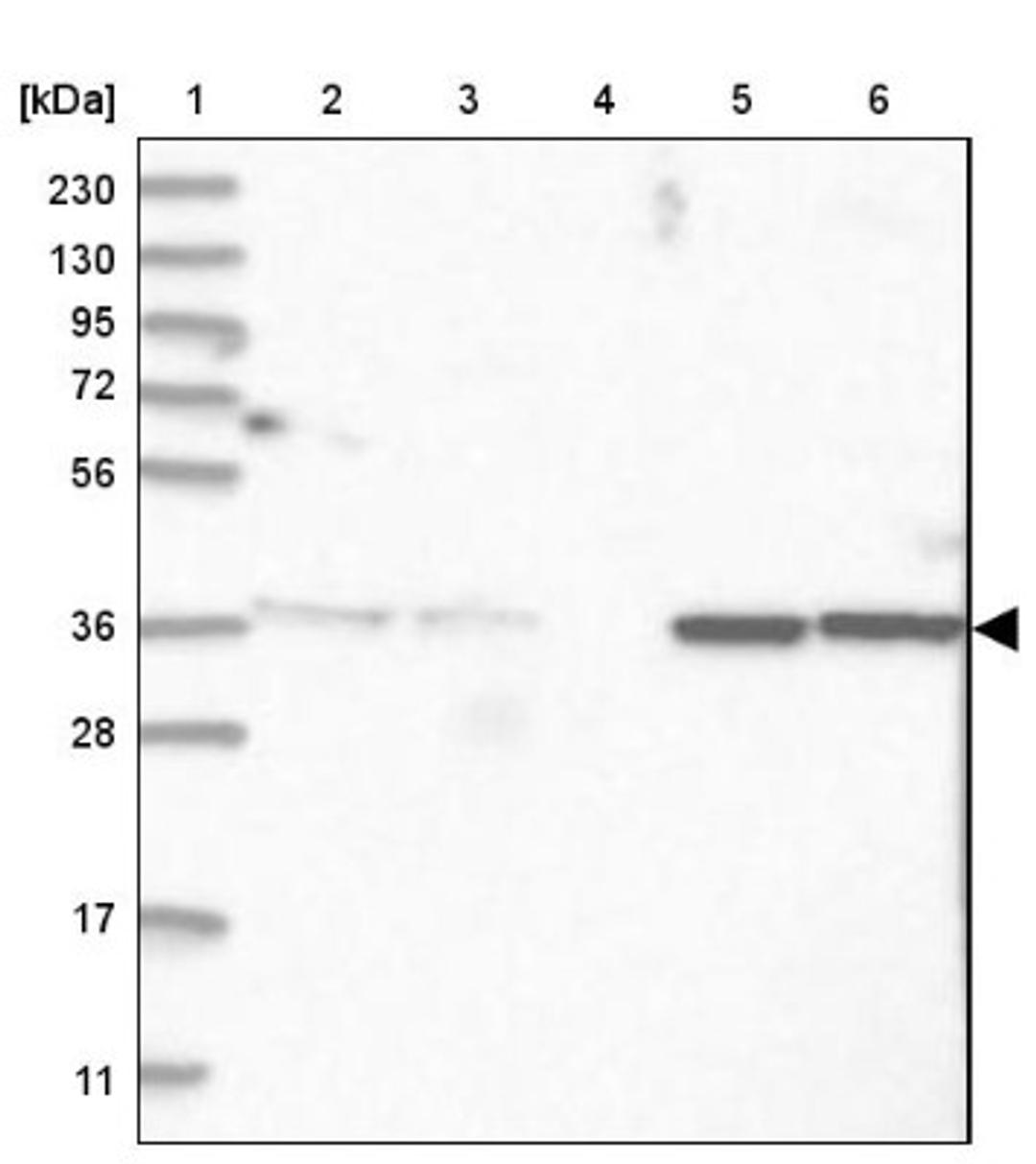 Western Blot: RBJ Antibody [NBP2-38333] - Lane 1: Marker [kDa] 230, 130, 95, 72, 56, 36, 28, 17, 11<br/>Lane 2: RT-4<br/>Lane 3: U-251 MG<br/>Lane 4: Human Plasma<br/>Lane 5: Liver<br/>Lane 6: Tonsil