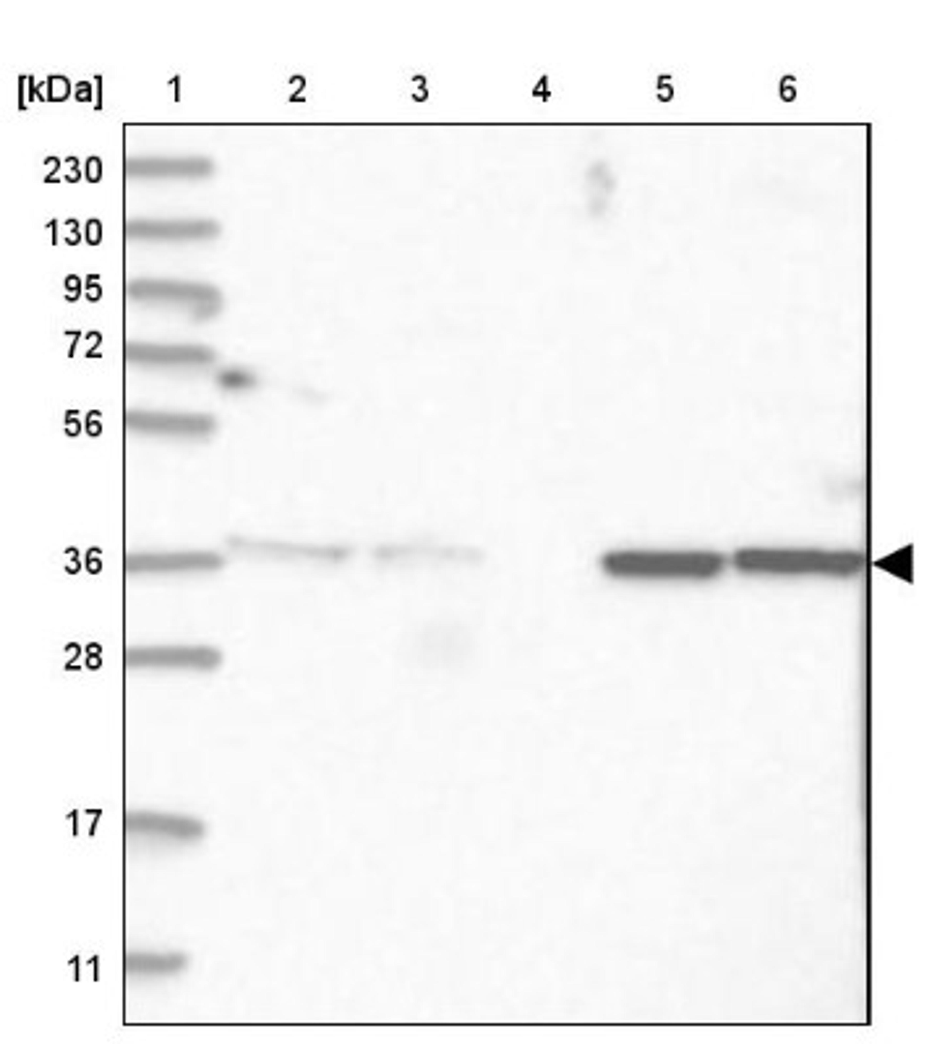 Western Blot: RBJ Antibody [NBP2-38333] - Lane 1: Marker [kDa] 230, 130, 95, 72, 56, 36, 28, 17, 11<br/>Lane 2: RT-4<br/>Lane 3: U-251 MG<br/>Lane 4: Human Plasma<br/>Lane 5: Liver<br/>Lane 6: Tonsil