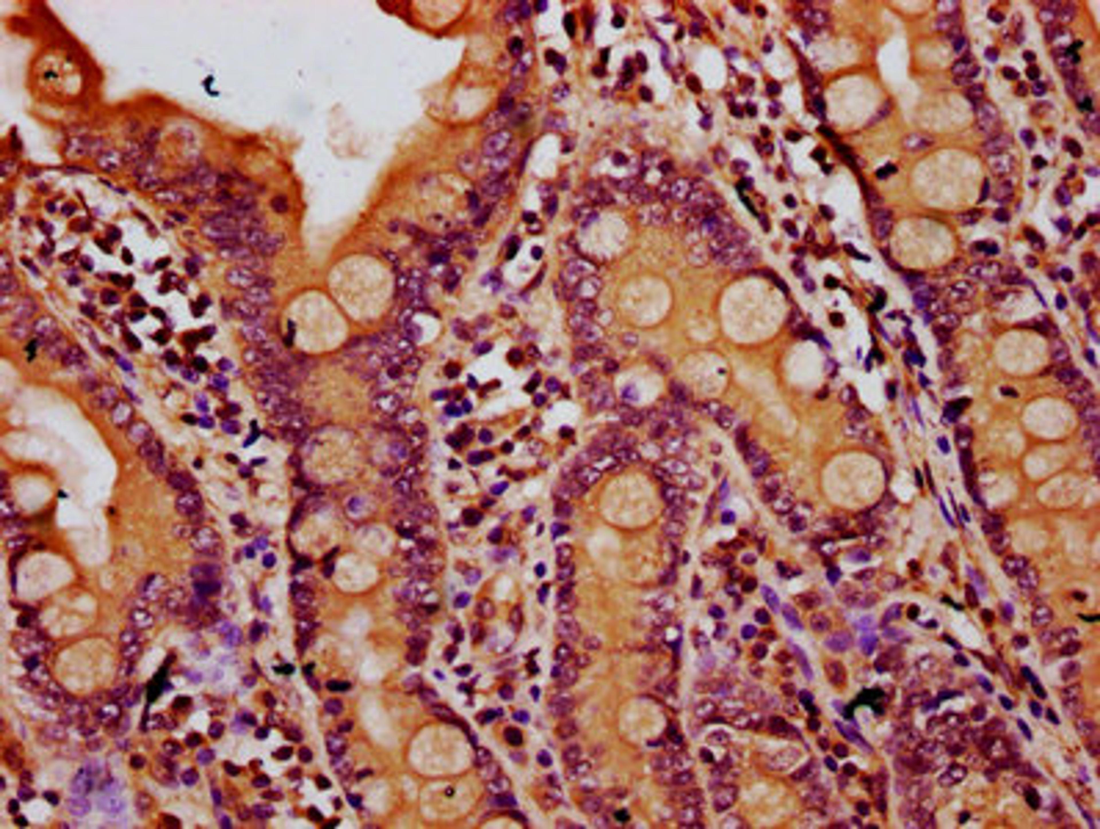 IHC image of CSB-PA615701LA01HU diluted at 1:500 and staining in paraffin-embedded human small intestine tissue performed on a Leica BondTM system. After dewaxing and hydration, antigen retrieval was mediated by high pressure in a citrate buffer (pH 6.0). Section was blocked with 10% normal goat serum 30min at RT. Then primary antibody (1% BSA) was incubated at 4&deg;C overnight. The primary is detected by a biotinylated secondary antibody and visualized using an HRP conjugated SP system.