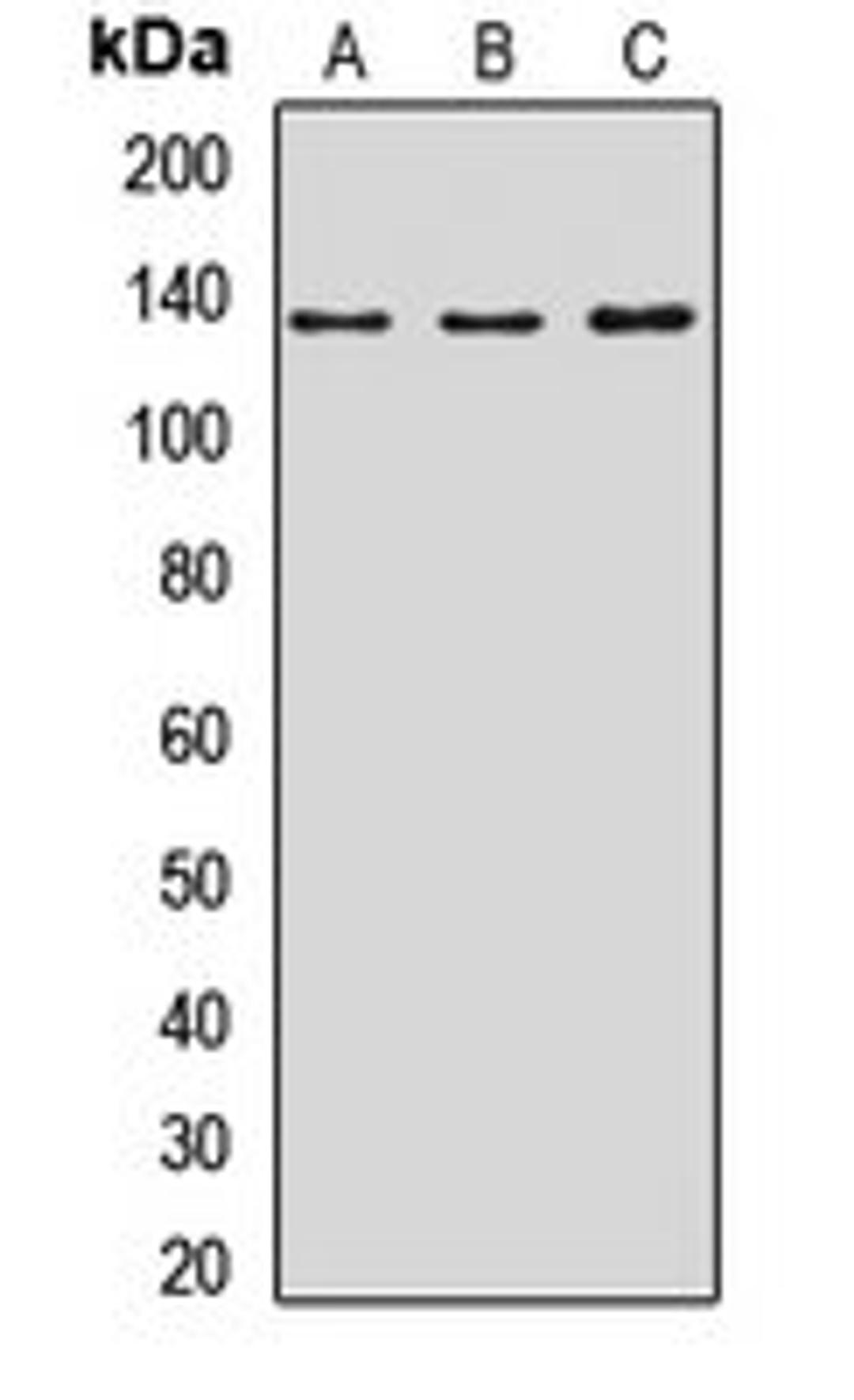 Western blot analysis of A431 (Lane1), MCF7 (Lane2), rat kidney (Lane3) whole cell lysates using NOMO1 antibody